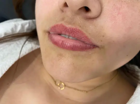 russian-lips-1-antes