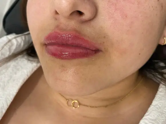 russian-lips-1-despues