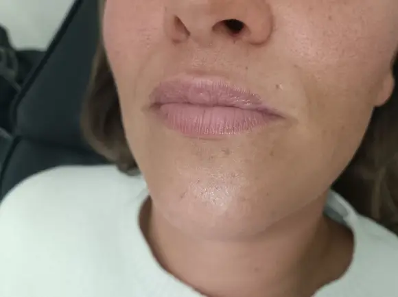 russian-lips-2-antes