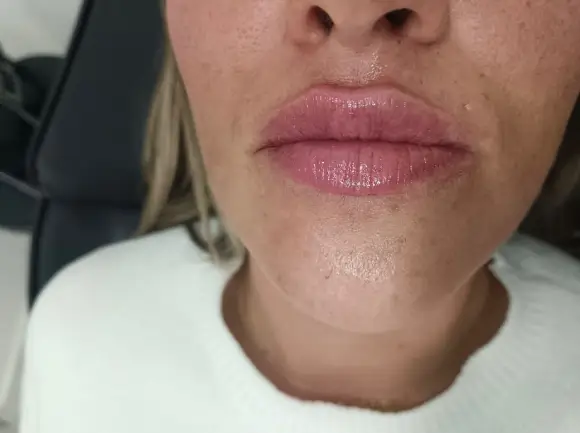 russian-lips-2-despues