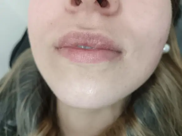 russian-lips-4-antes