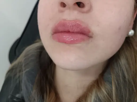 russian-lips-4-despues